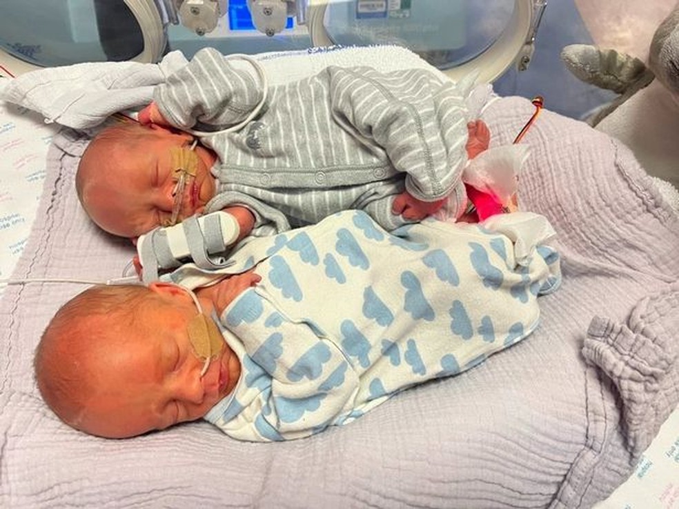 Os gêmeos recém-nascidos — Foto: Reprodução/Mirror