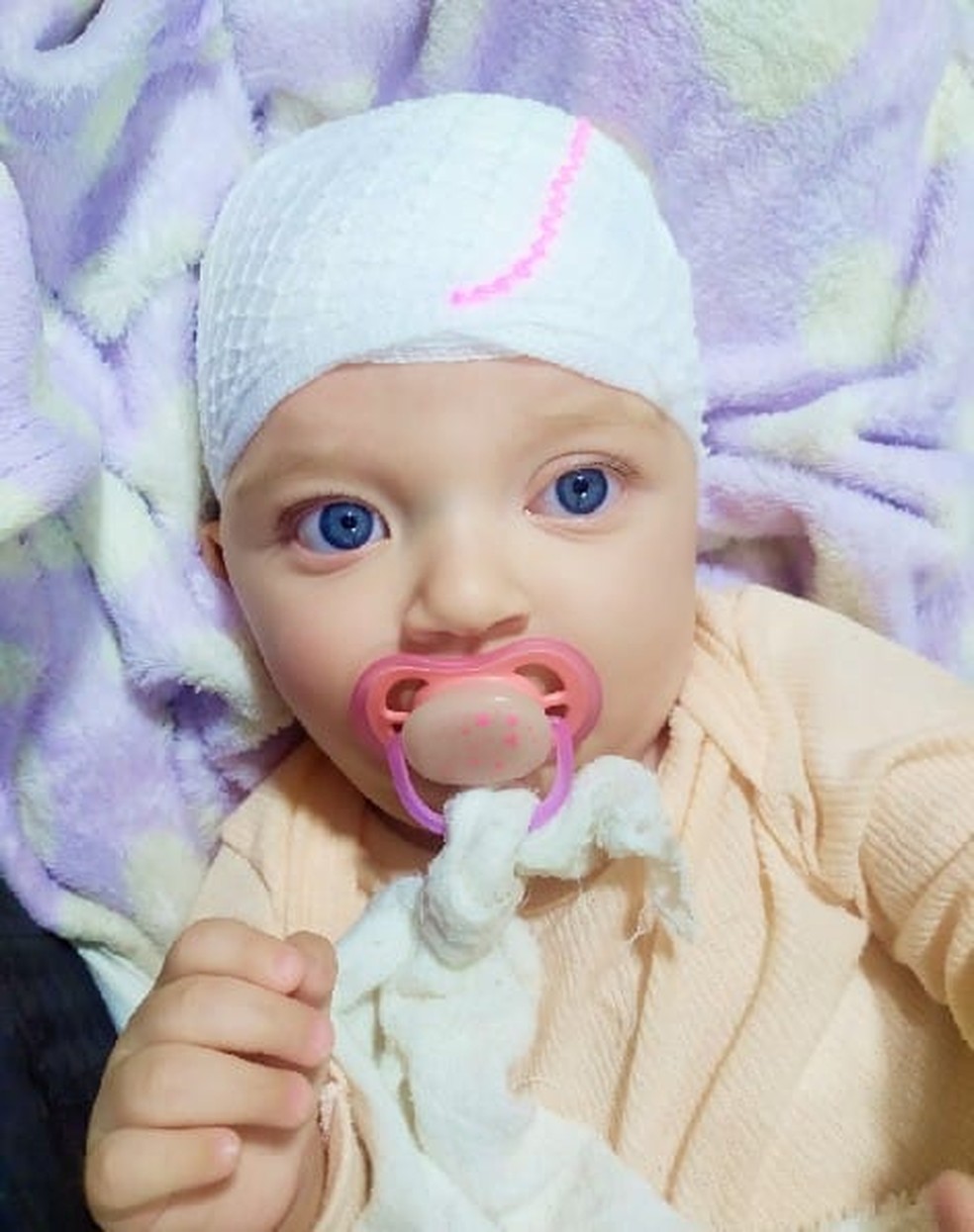 Lívia foi diagnosticada com a condição aos 6 meses — Foto: Arquivo pessoal