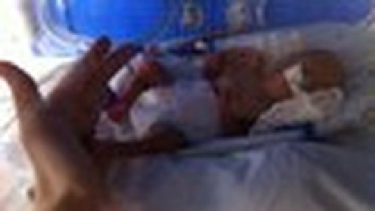 "Numa UTI neonatal, o amor dos pais é visto na árdua rotina entre hospital e casa, nas incessantes tentativas de tirar leite materno"