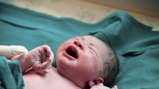 O que o teste de Apgar diz sobre a saúde do recém-nascido?