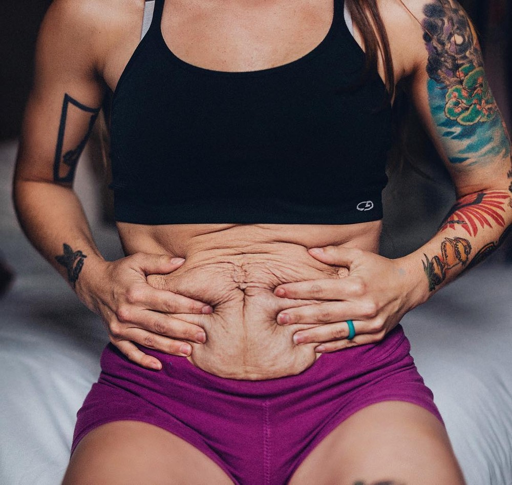 Barriga pós-parto: exercícios para perder, dicas e fotos de antes e depois