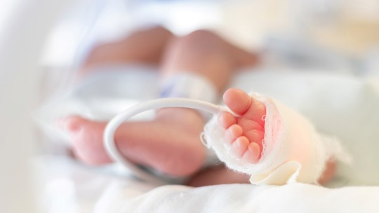 "Consequências a longo prazo de um nascimento prematuro afetam diretamente a saúde psíquica, emocional e social dos pais"