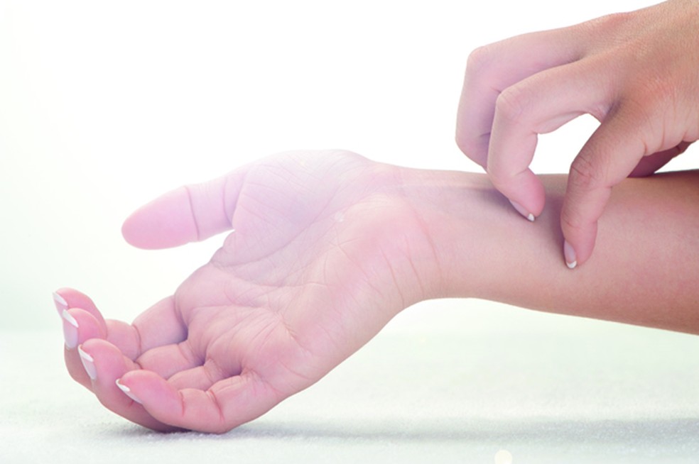 Um dos sintomas da colestase gestacional é a coceira na palma das mãos — Foto: Courtney Keating / Getty Images