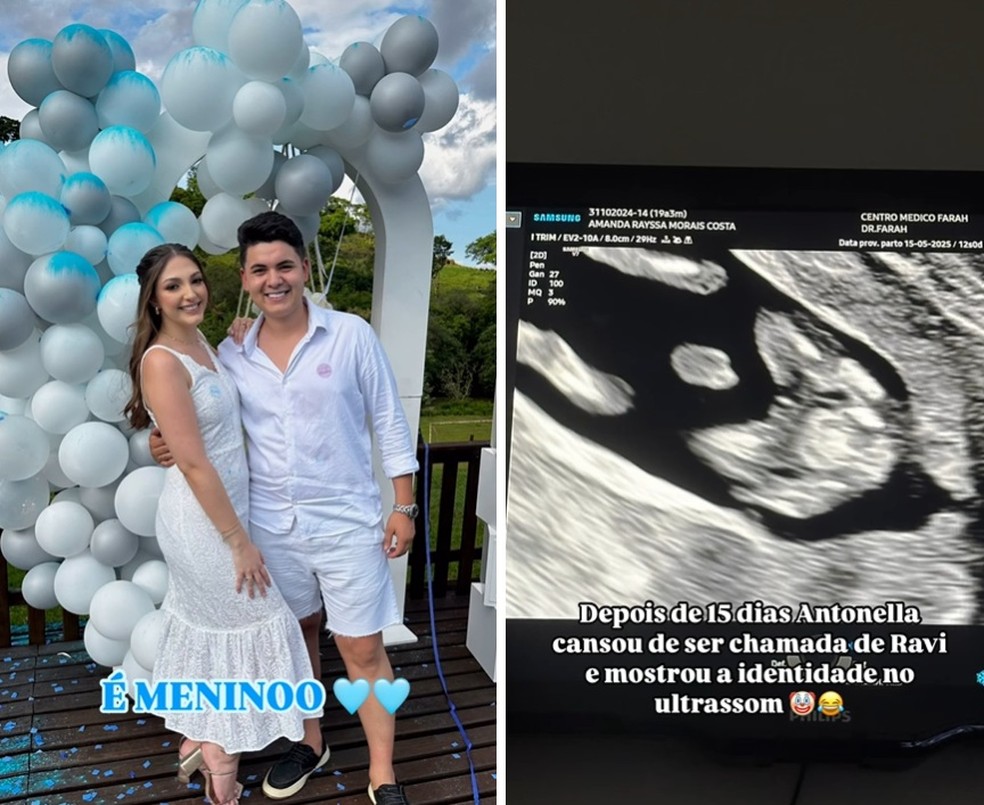 Aquele 1%”: sexagem fetal dá errado e mãe descobre verdadeiro sexo do bebê  semanas depois