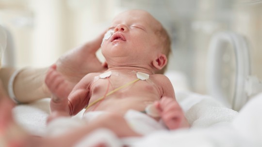 Prematuros: tudo sobre o calendário de vacinação dos bebês que chegam antes da hora