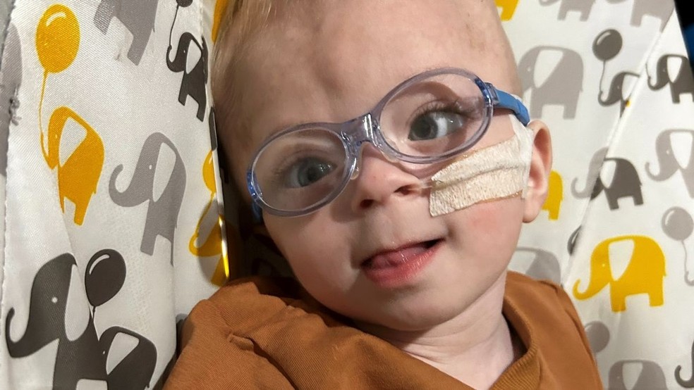 Bebê que nasceu sem parte do cérebro completa 1 ano