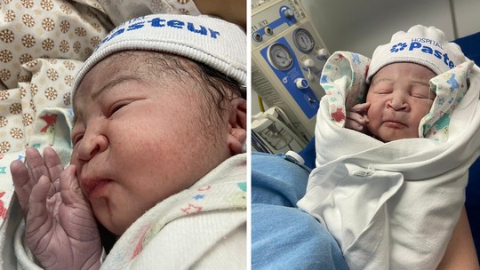 Bebê nasce com nariz achatado e mãe brinca em post viral: “Rinoplastia natural”